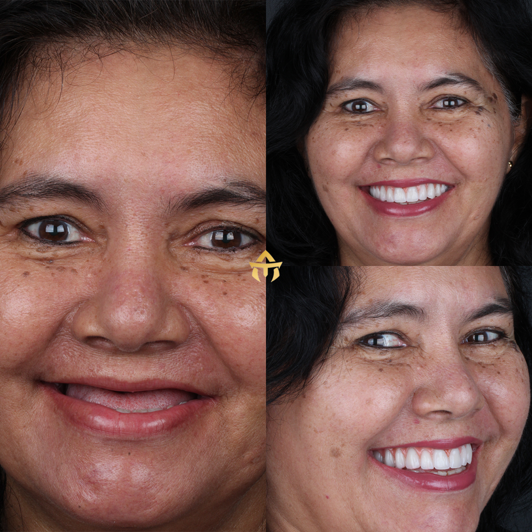 antes e depois 5